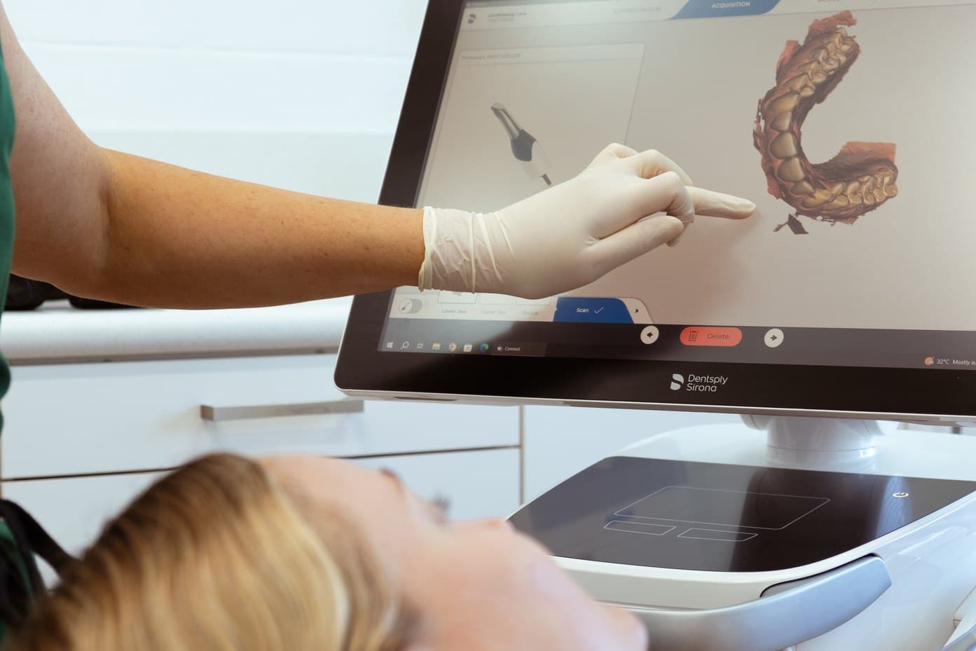 A 3D scan of teeth on the intraoral scanner screen