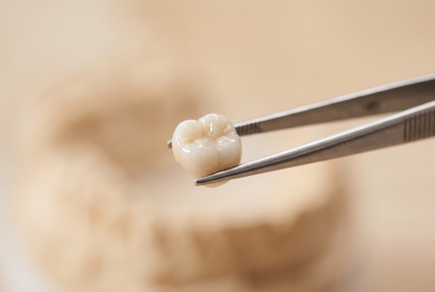 A ceramic crown held in tweezers