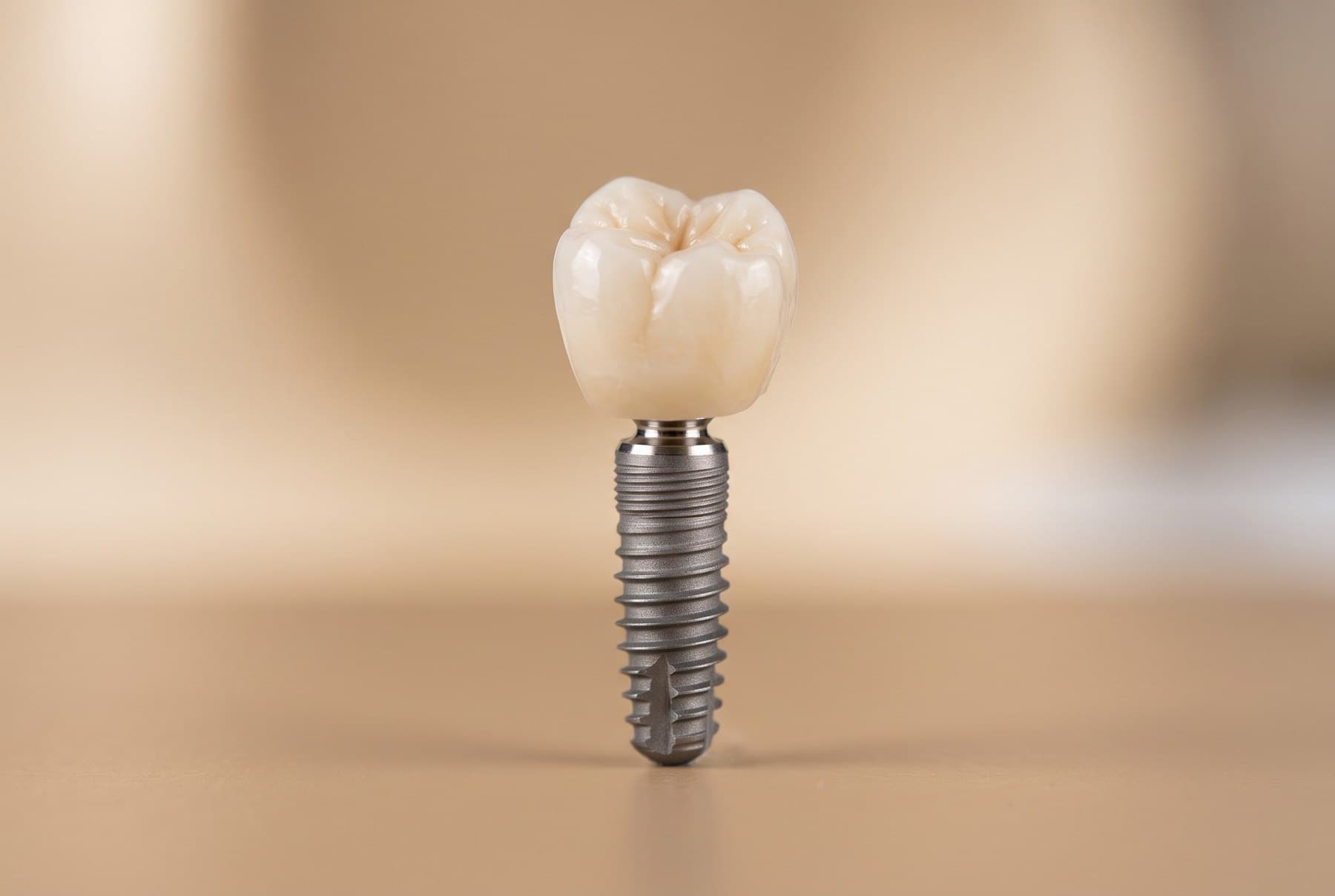 A dental implant with its crown