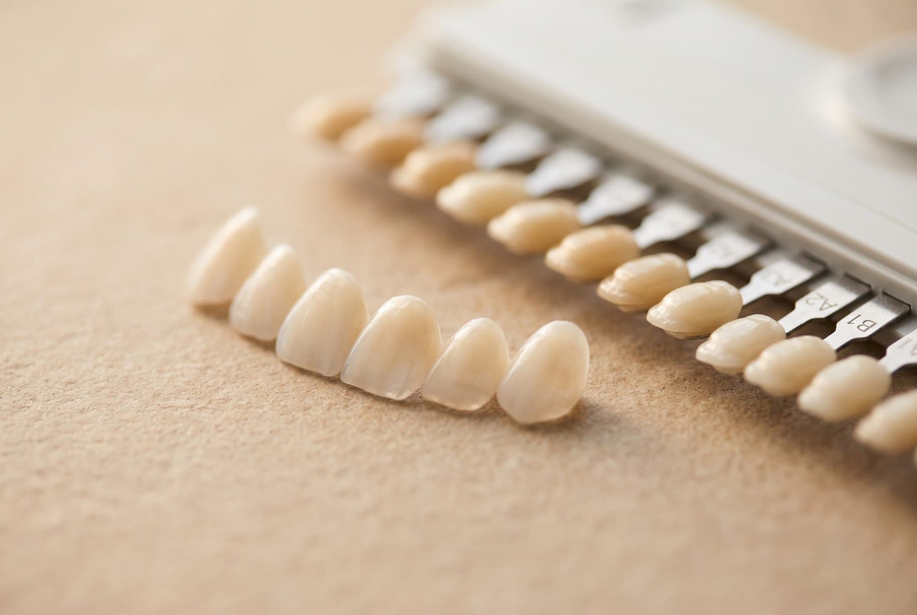 Veneers beside a shade guide
