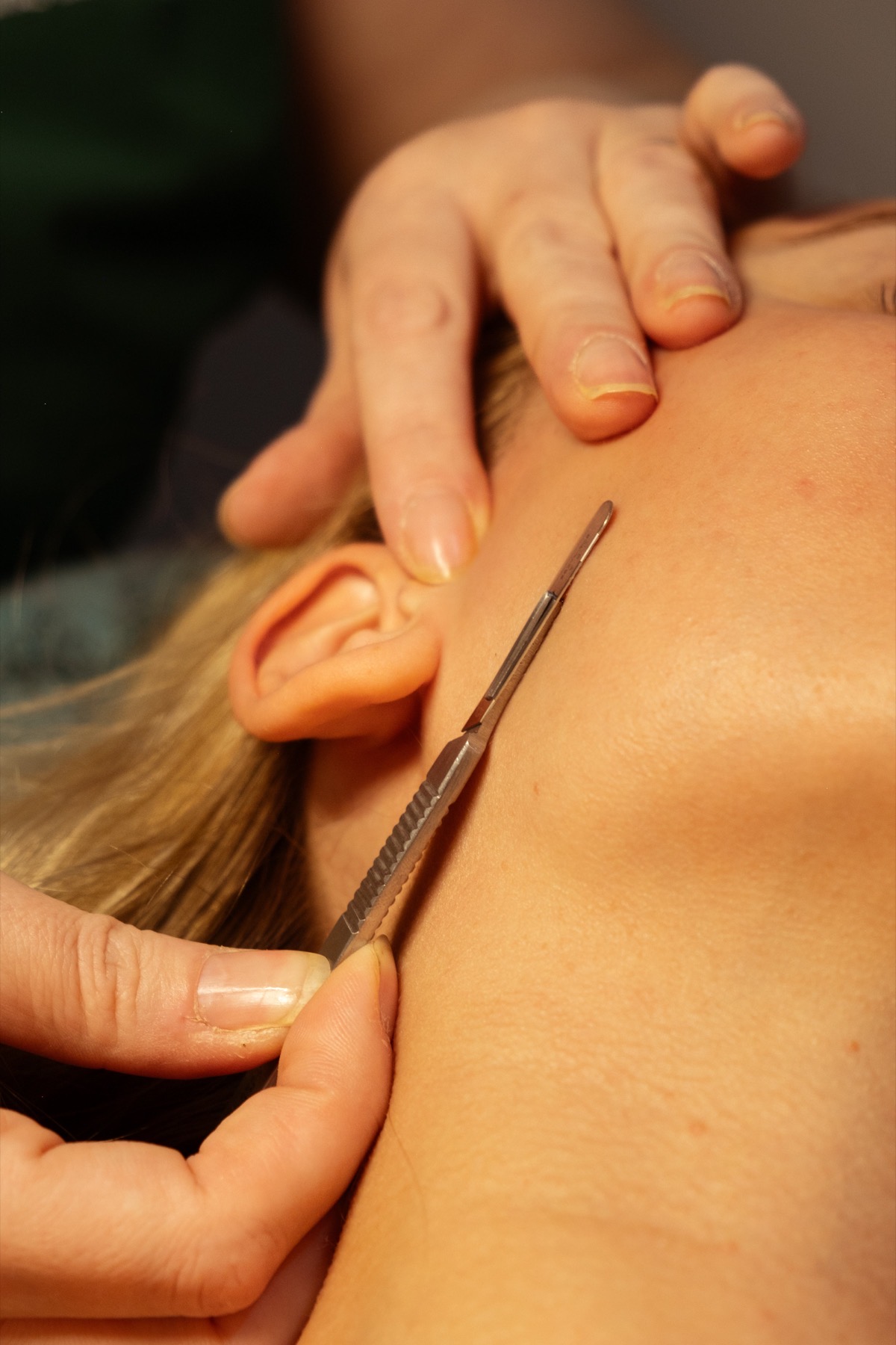 a girl doing micro needling 